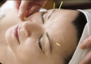 Acupuntura Facial barcelona
