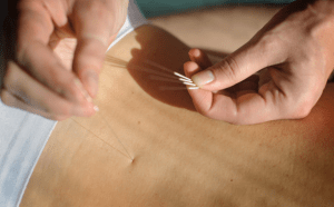 acupuntura barcelona endiometrosis